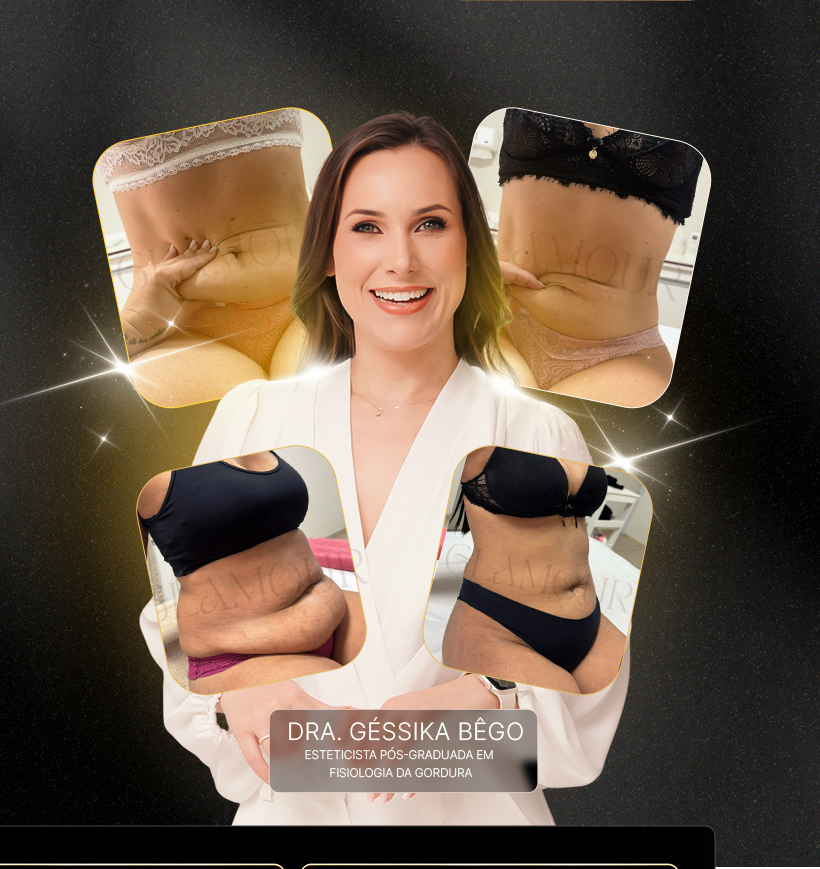 Dra. Géssika Bêgo, esteticista pós-graduada em Fisiologia da Gordura, com fotos reais de antes e depois.
